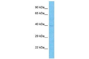 Host:  Rabbit  Target Name:  TFDP2  Sample Type:  Thyroid Tumor lysates  Antibody Dilution:  1. (DP2 antibody  (C-Term))