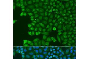 Immunofluorescence analysis of U2OS cells using ABCE1 Polyclonal Antibody at dilution of 1:100. (ABCE1 antibody)