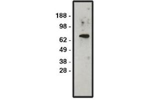 Image no. 1 for anti-Solute Carrier Family 9, Subfamily A (NHE1, Cation Proton Antiporter 1), Member 1 (SLC9A1) antibody (ABIN4620363) (SLC9A1 antibody)