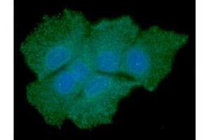 ICC/IF analysis of SOD1 in Hep3B cells line, stained with DAPI (Blue) for nucleus staining and monoclonal anti-human SOD1 antibody (1:100) with goat anti-mouse IgG-Alexa fluor 488 conjugate (Green). (SOD1 antibody  (AA 1-154))