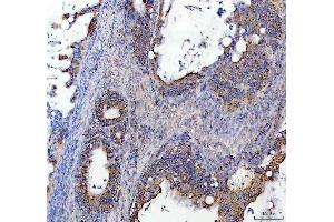 IHC analysis of SOCS5 using anti-SOCS5 antibody (ABIN7601562). (SOCS5 antibody  (AA 386-536))