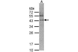 WB Image Sample (30 ug of whole cell lysate) A: 293T 12% SDS PAGE antibody diluted at 1:500 (CAMK1D antibody)