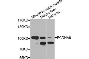 Western blot analysis of extracts of various cell lines, using PCDHA6 antibody. (PCDHA6 antibody)