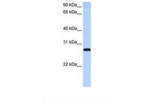 Image no. 1 for anti-MAX-Like Protein X (MLX) (AA 197-246) antibody (ABIN6738772) (MLX antibody  (AA 197-246))