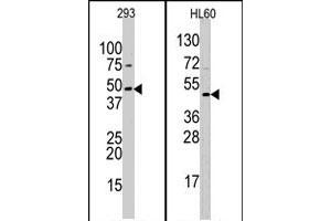 Western blot analysis of SUV39H2 polyclonal antibody  in 293 and HL-60 cell line lysates (35 ug/lane).