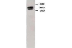 Western Blotting (WB) image for anti-Hypoxia Inducible Factor 1, alpha Subunit (Basic Helix-Loop-Helix Transcription Factor) (HIF1A) (N-Term) antibody (ABIN1107529)