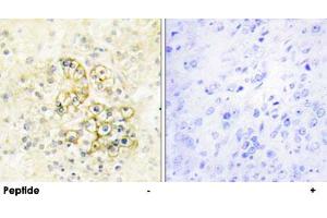 Immunohistochemistry analysis of paraffin-embedded human prostate tissue using PMEPA1 polyclonal antibody .