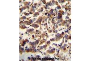 Immunohistochemistry (IHC) image for anti-Transcription Factor A, Mitochondrial (TFAM) antibody (ABIN5015230) (TFAM antibody)
