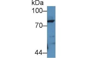 Detection of POSTN in Rat Lung lysate using Polyclonal Antibody to Periostin (POSTN) (Periostin antibody  (AA 24-173))