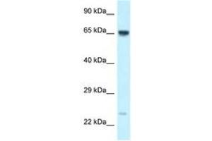 Image no. 1 for anti-Catenin, beta Like 1 (CTNNBL1) (C-Term) antibody (ABIN6747698) (CTNNBL1 antibody  (C-Term))