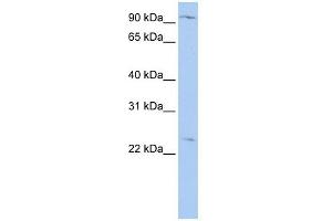 OSBPL8 antibody used at 1 ug/ml to detect target protein. (OSBPL8 antibody  (N-Term))