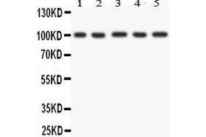 Anti- FGFR4 antibody, Western blotting All lanes: Anti FGFR4  at 0. (FGFR4 antibody  (AA 22-206))