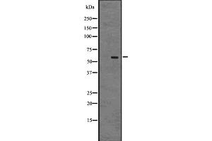 Western blot analysis of GPR75 expression in A431 whole cell lysate ,The lane on the left is treated with the antigen-specific peptide. (GPR75 antibody  (Internal Region))