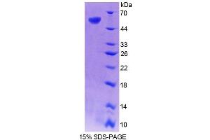 SDS-PAGE (SDS) image for Isocitrate Dehydrogenase 1 (NADP+), Soluble (IDH1) (AA 99-325) protein (His tag,GST tag) (ABIN2123090) (IDH1 Protein (AA 99-325) (His tag,GST tag))