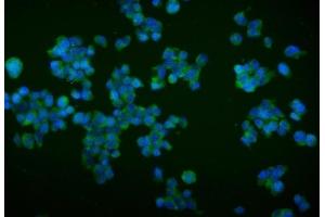 IF analysis of TRIM16 using anti-TRIM16 antibody (ABIN7602226).