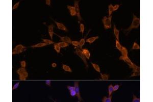 Immunofluorescence analysis of NIH/3T3 cells using UBE2J1 Polyclonal Antibody at dilution of 1:100. (UBE2J1 antibody)