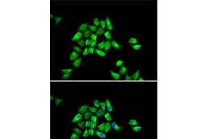 Immunofluorescence analysis of HeLa cells using DCTN1 Polyclonal Antibody (Dynactin 1 antibody)