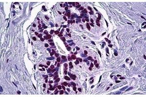 Human Breast: Formalin-Fixed, Paraffin-Embedded (FFPE) (STAT1 antibody  (AA 694-743))