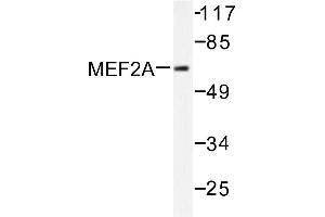Image no. 1 for anti-Myocyte Enhancer Factor 2A (MEF2A) antibody (ABIN265517) (MEF2A antibody)