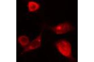 ABIN6274118 staining HT29 cells by IF/ICC. (T-Box 10 antibody  (Internal Region))