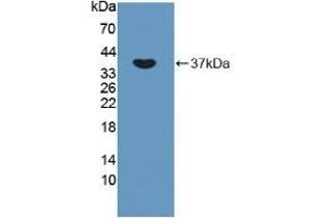 Detection of Recombinant OXTR, Rat using Polyclonal Antibody to Oxytocin Receptor (OXTR) (Oxytocin Receptor antibody  (AA 43-129))