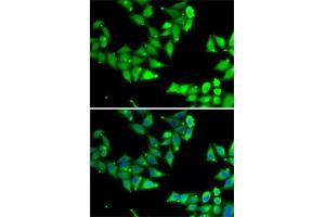 Immunofluorescence analysis of U2OS cells using OGFR Rabbit pAb (ABIN6128395, ABIN6145006, ABIN6145007 and ABIN6222871) at dilution of 1:50 (40x lens). (OGFR antibody  (AA 1-280))