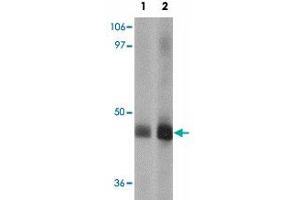 Western blot analysis of EFCAB4A in human lung tissue lysate with EFCAB4A polyclonal antibody  at (1) 1 and (2) 2 ug/mL. (EFCAB4A antibody)