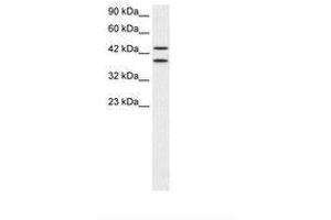 Image no. 1 for anti-Zinc Finger Protein 839 (ZNF839) (AA 530-579) antibody (ABIN202500) (ZNF839 antibody  (AA 530-579))