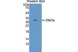 Western blot analysis of the recombinant protein. (URGCP antibody  (AA 689-924))
