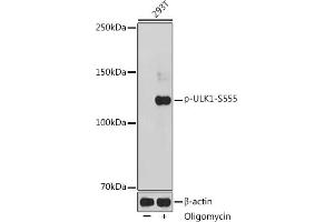 Western blot analysis of extracts of 293T cells, using Phospho-ULK1-S555 antibody (ABIN6135333, ABIN6136282, ABIN6136283 and ABIN6225654) at 1:1000 dilution.