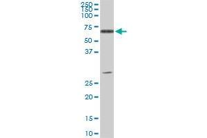 ATP6AP1 monoclonal antibody (M01), clone 3A2. (ATP6AP1 antibody  (AA 51-150))