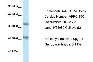 Western Blotting (WB) image for anti-Caspase Recruitment Domain Family, Member 10 (CARD10) (C-Term) antibody (ABIN970291) (CARD10 antibody  (C-Term))