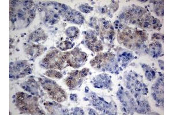 TIA1 antibody