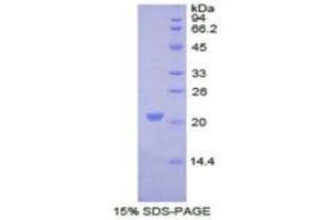 SDS-PAGE analysis of Human COL8A1 Protein.