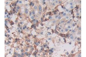 Detection of MHCC in Human Stomach Tissue using Polyclonal Antibody to Major Histocompatibility Complex Class I C (MHCC) (MHCC (AA 48-305) antibody)