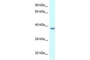 Image no. 1 for anti-Uroplakin 3B (UPK3B) (AA 247-296) antibody (ABIN6747778)