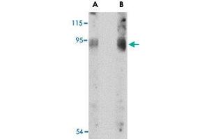 Western blot analysis of BICD2 in A-549 cell lysate with BICD2 polyclonal antibody  at (A) 1 and (B) 2 ug/mL . (BICD2 antibody  (C-Term))