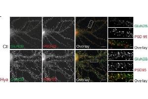 Expression of GluN2B in rat hippocampal neuronsImmunocytochemistry of living rat dissociated hippocampal neurons. (GRIN2B antibody  (Extracellular))