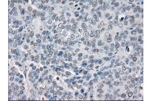 Immunohistochemical staining of paraffin-embedded Kidney tissue using anti-PPP5Cmouse monoclonal antibody. (PP5 antibody)