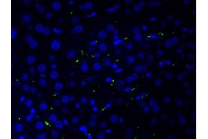 ABIN6266515 at 1/200 staining human liver tissue cells by ICC/IF. (COL2A1 antibody  (N-Term))