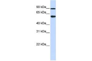 Western Blotting (WB) image for anti-Alcohol Dehydrogenase, Iron Containing, 1 (ADHFE1) antibody (ABIN2459564) (ADHFE1 antibody)