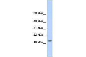 CDRT4 antibody used at 1 ug/ml to detect target protein. (CDRT4 antibody  (Middle Region))