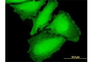 Immunofluorescence of purified MaxPab antibody to CAMK2G on HeLa cell. (CAMKII gamma antibody  (AA 1-527))