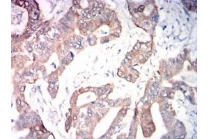Immunohistochemistry (IHC) image for anti-ADAM Metallopeptidase Domain 10 (ADAM10) antibody (ABIN7193611)