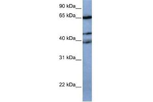 Western Blot showing ZNF681 antibody used at a concentration of 1-2 ug/ml to detect its target protein. (ZNF681 antibody  (N-Term))