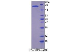 SDS-PAGE analysis of Human SCRN1 Protein.