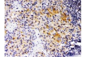 IHC analysis of SKAP55 using anti-SKAP55 antibody (ABIN3044545). (SKAP1 antibody  (Middle Region))