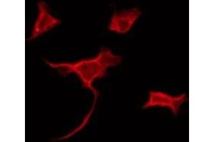 ABIN6275156 staining Hela by IF/ICC. (GLRB antibody  (Internal Region))