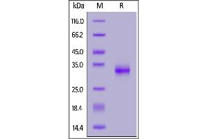 SARS-CoV-2 S protein RBD (K417T, E484K, N501Y), His Tag on  under reducing (R) condition.