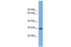 WB Suggested Anti-RAB40C Antibody Titration: 0. (RAB40C antibody  (N-Term))